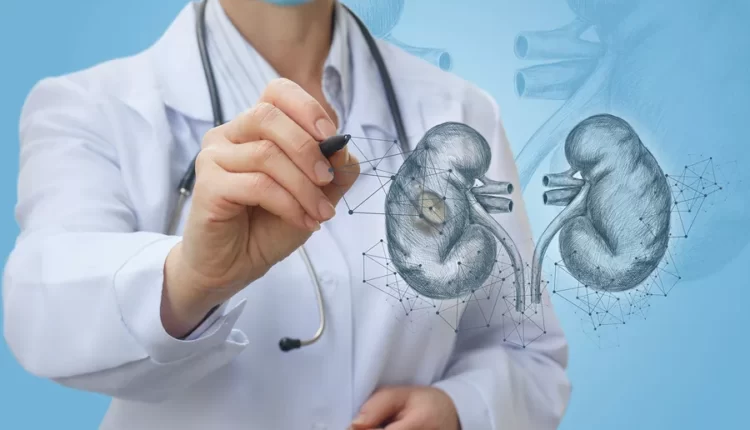 سرطان الكلى