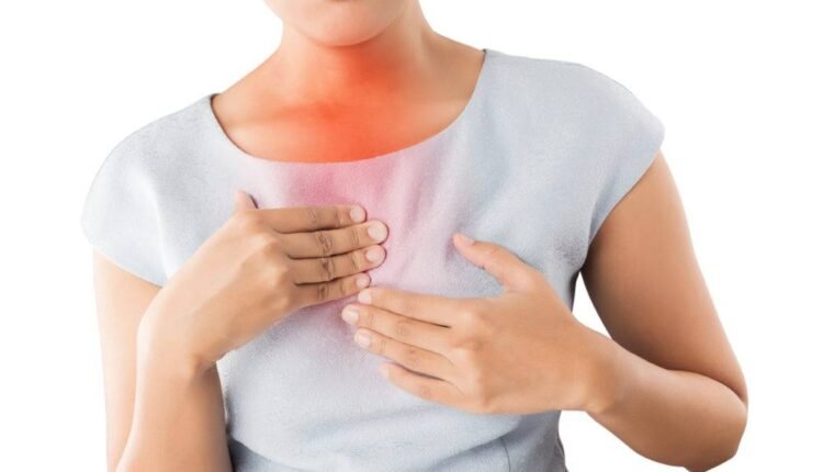 الشعور بالحرقة