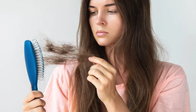 تساقط الشعر