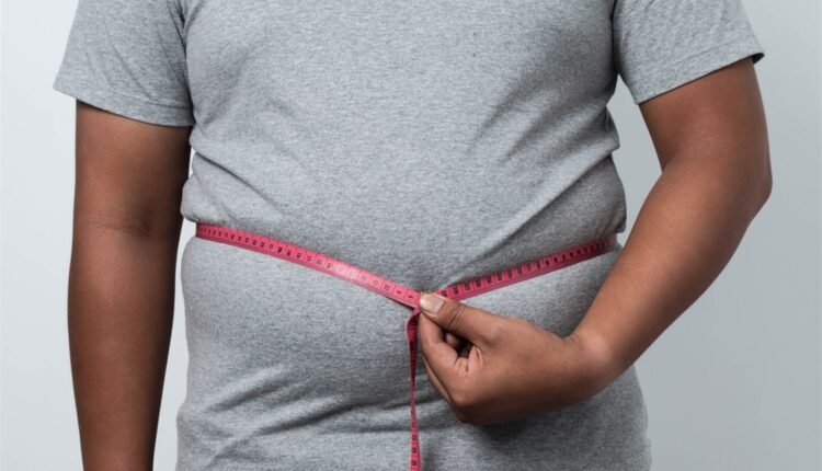 السمنة المفرطة