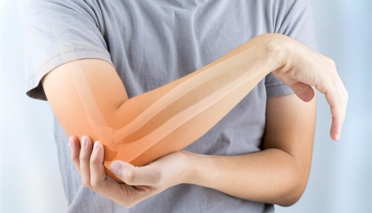 تقوية العظام