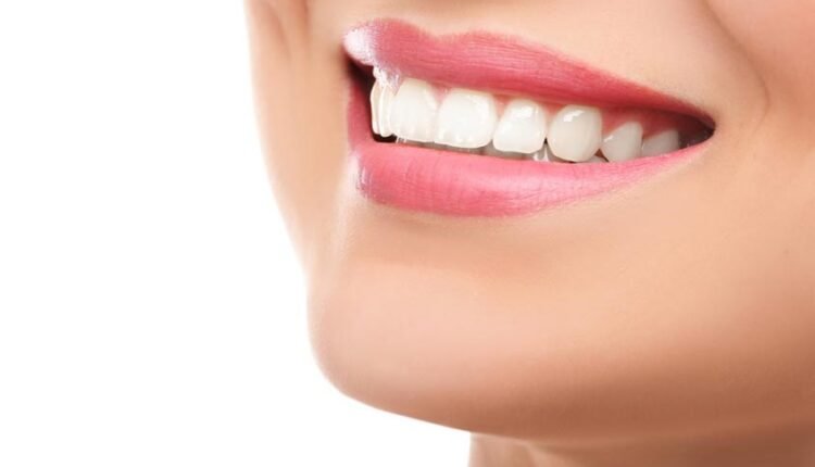 أسنان بيضاء